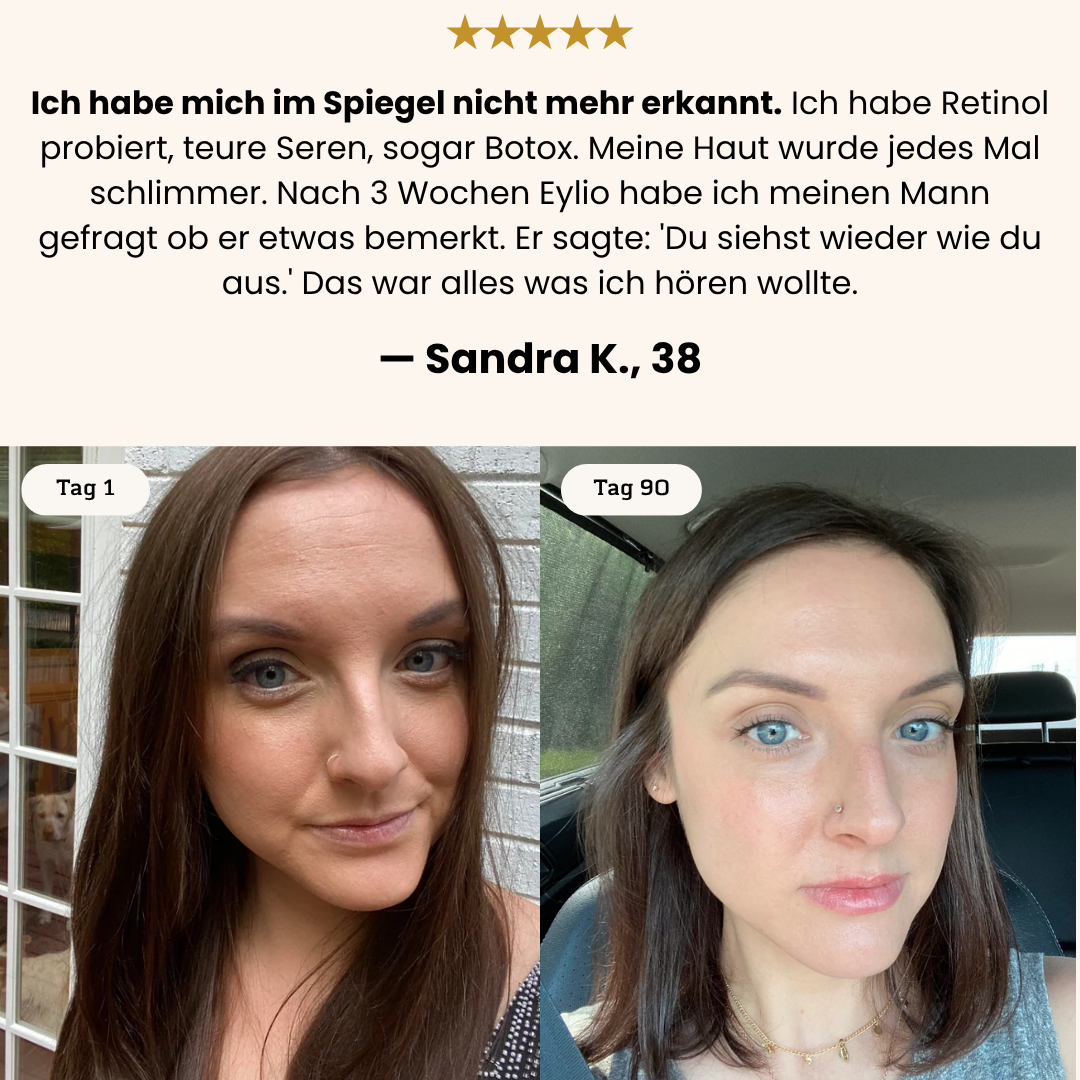 Revival System - 4-Schritte Piezo-Aktive Zellerneuerung für reife Haut