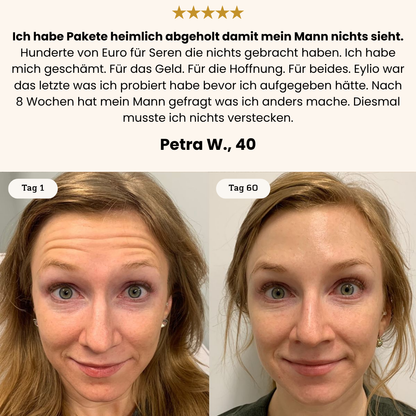 Revival System - 4-Schritte Piezo-Aktive Zellerneuerung für reife Haut
